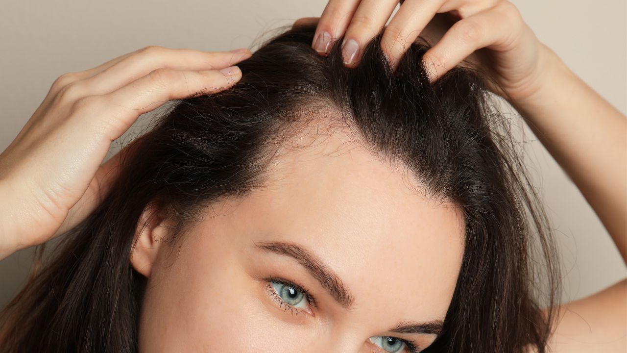 female hair loss with Dr. Kopelman