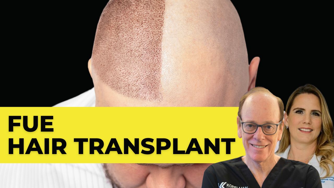 FUE Hair transplant