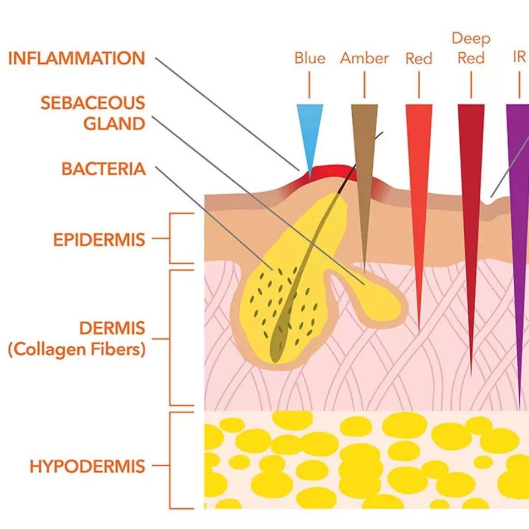 LLLT Therapy Works for Hair Growth