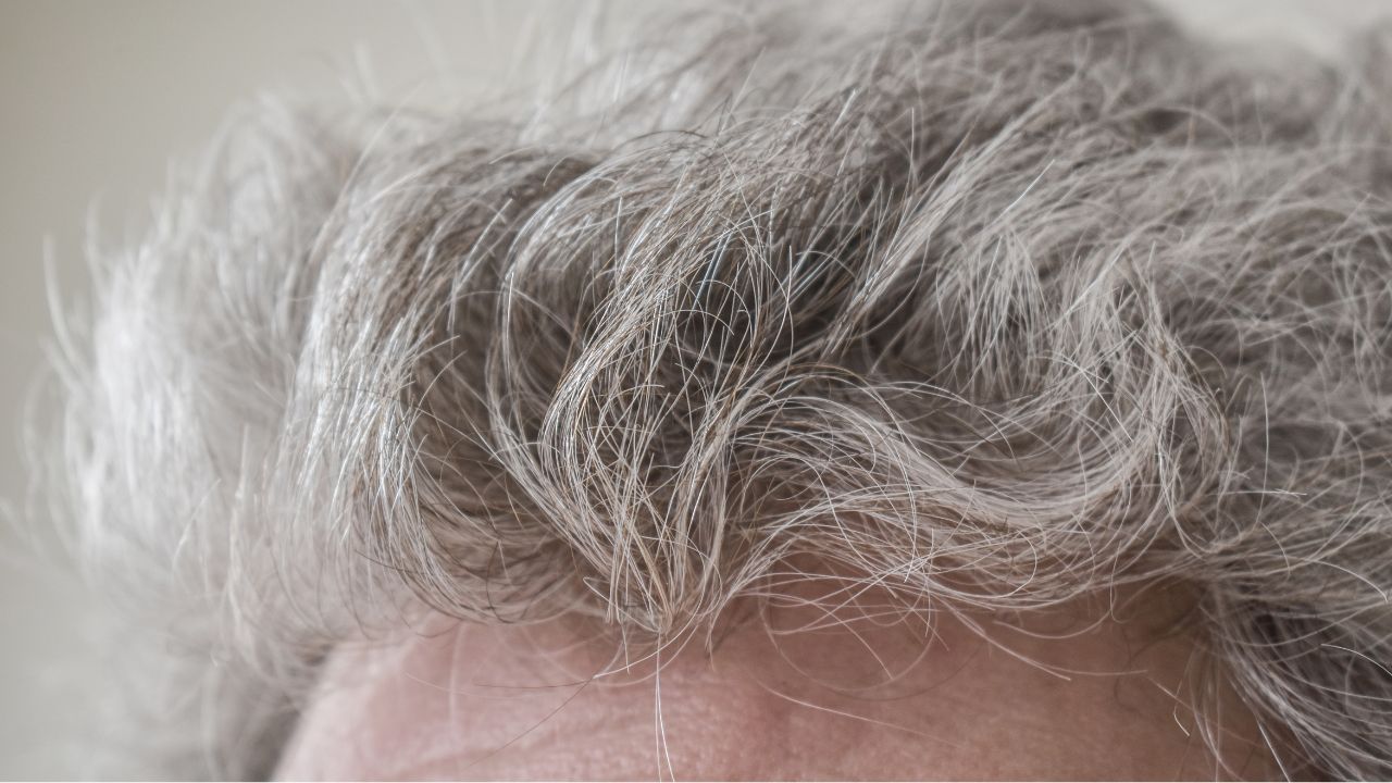 Minoxidil _ hair loss treatment