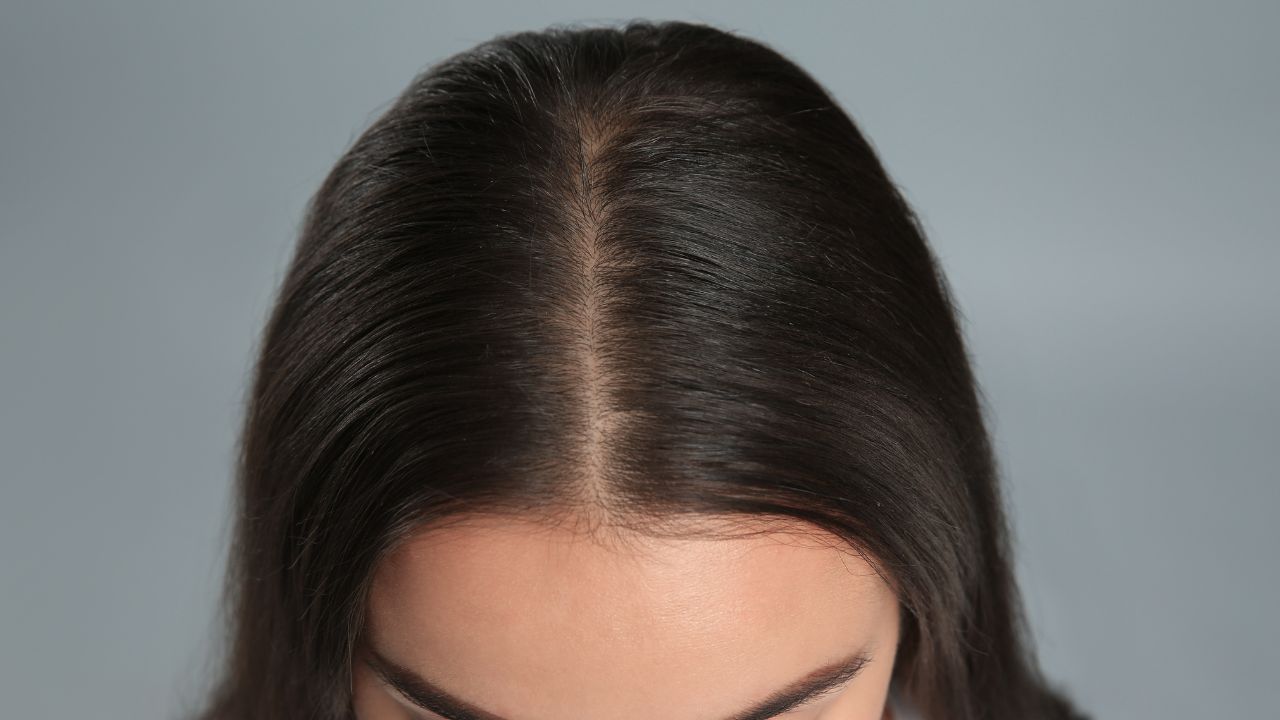 PRP _ hair loss treatment