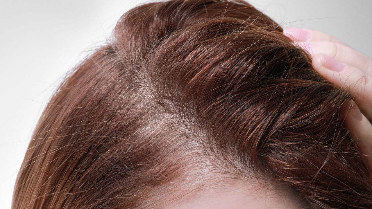 Spironolactone_ hair loss treatment