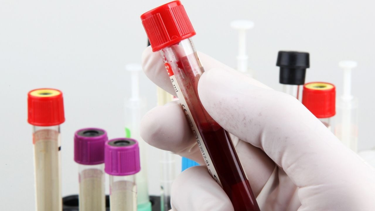 blood tests for hair loss