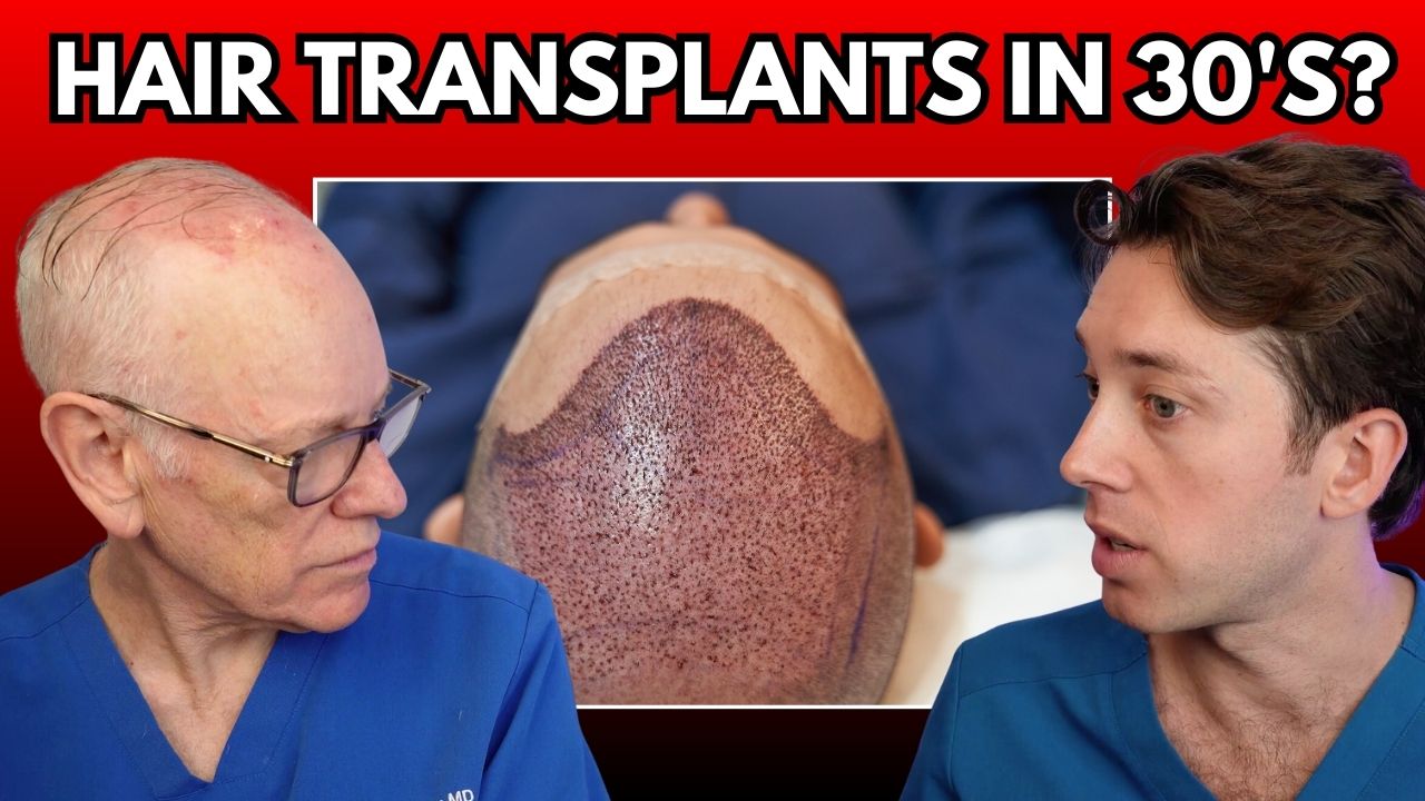 should you have a hair transplant?