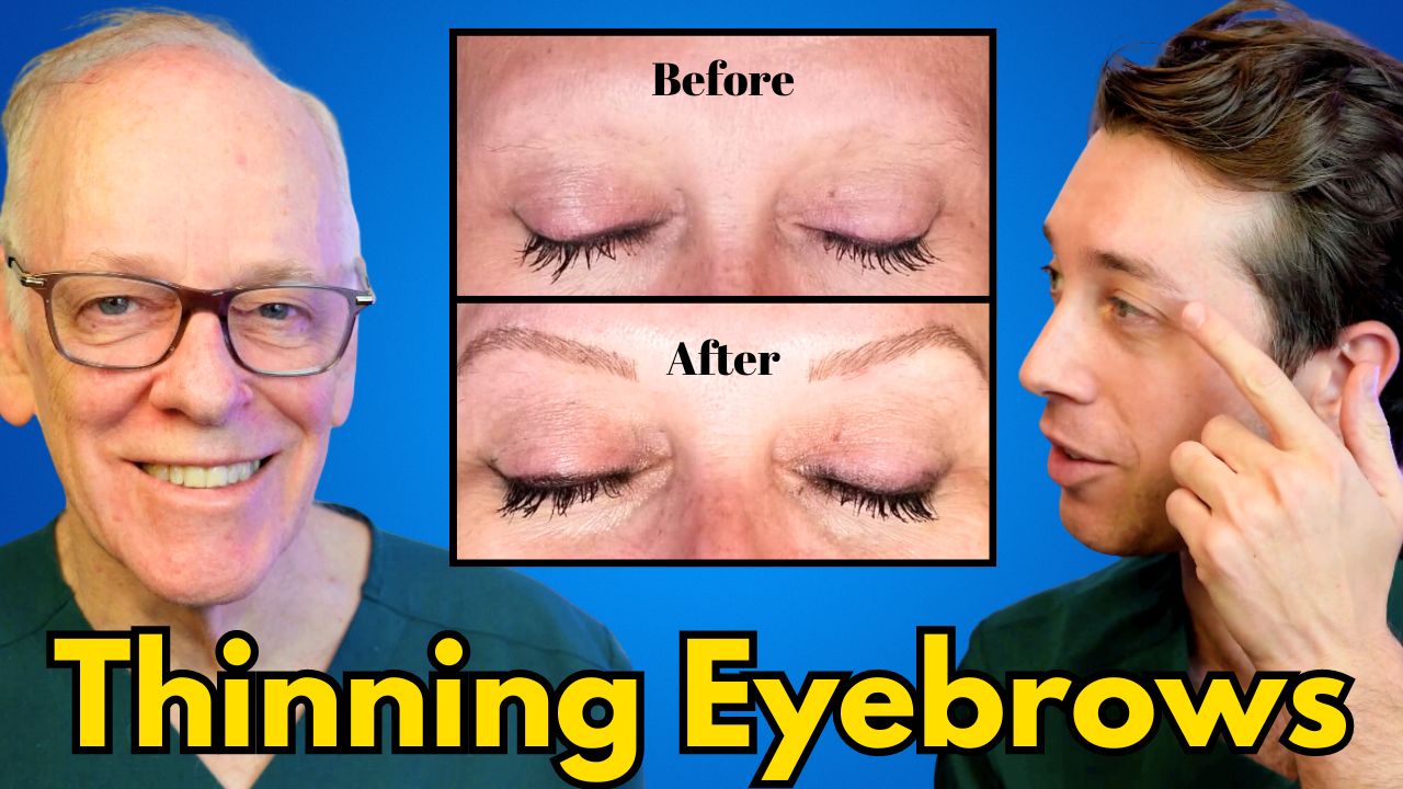 thinning eyebrows _ treatments (1)