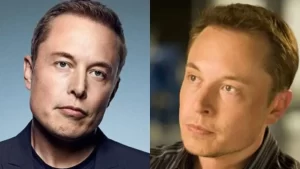 Elon Musk's Hair Transplant