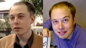 Elon Musk's Hair in 90s