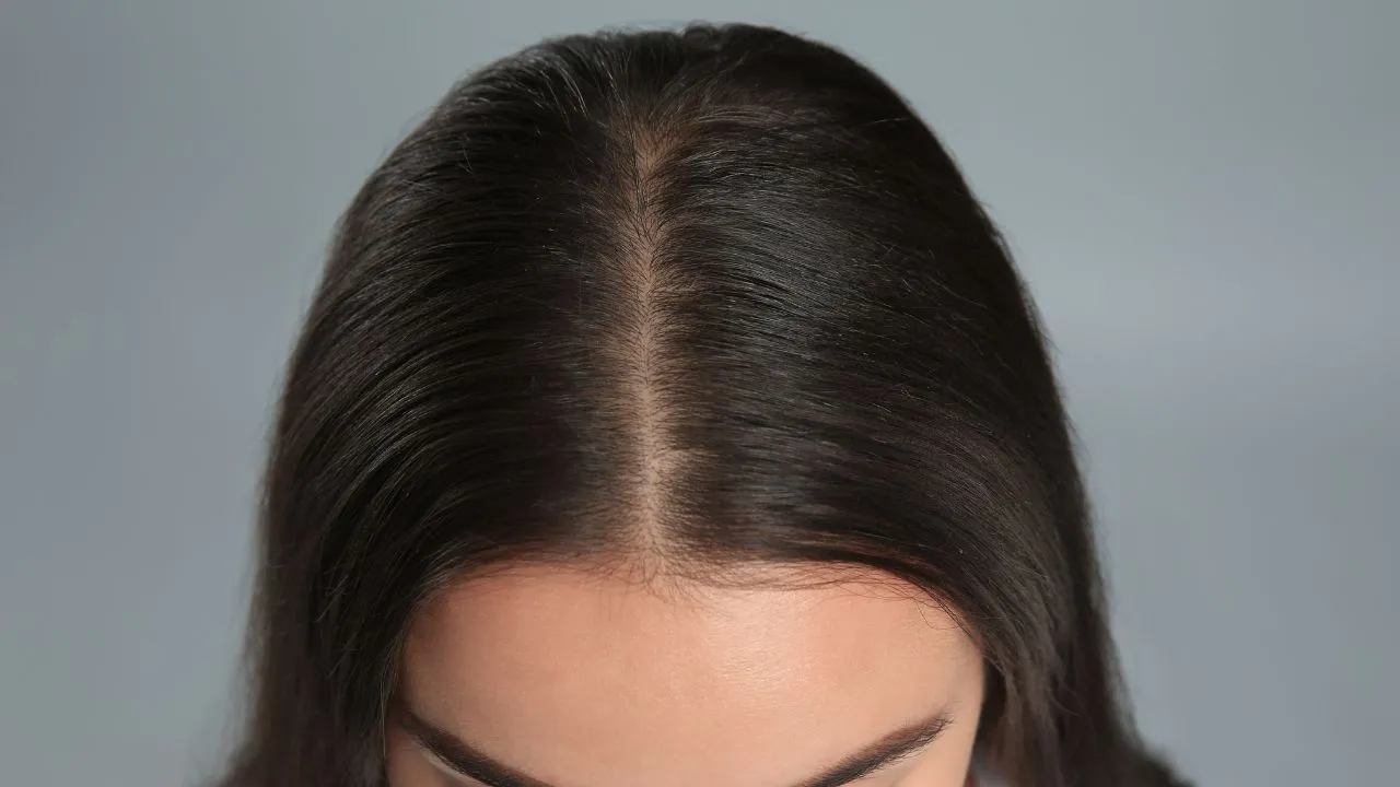 Miami Hair Loss PRP