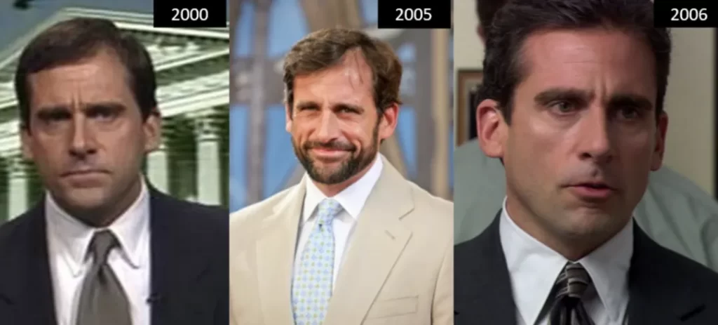 Steve Carell _ hair transplant