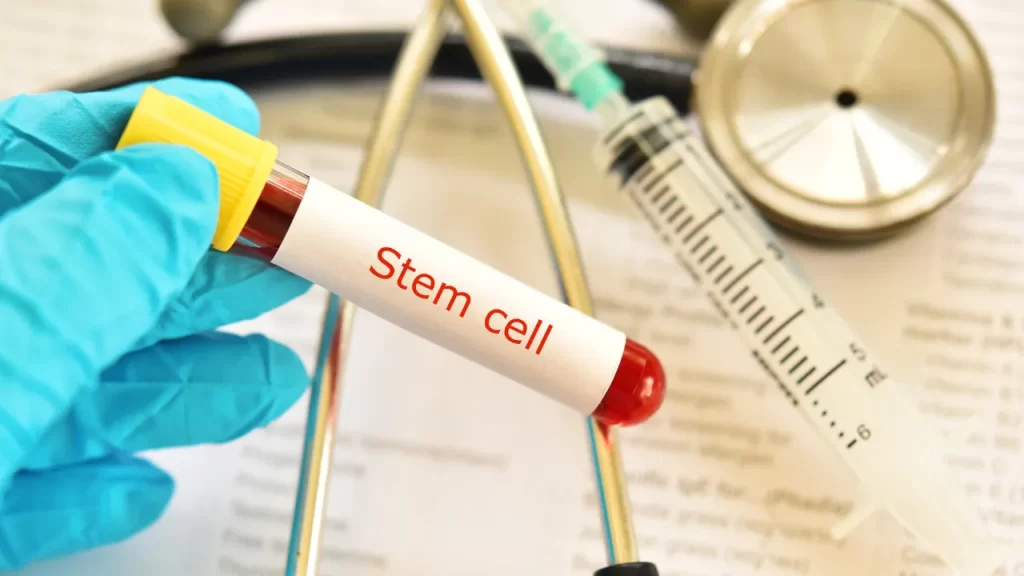 stem cell and hair transplant