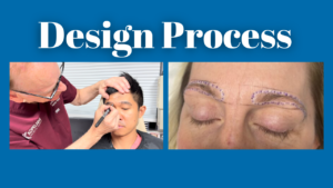 eyebrow hair transplant guide