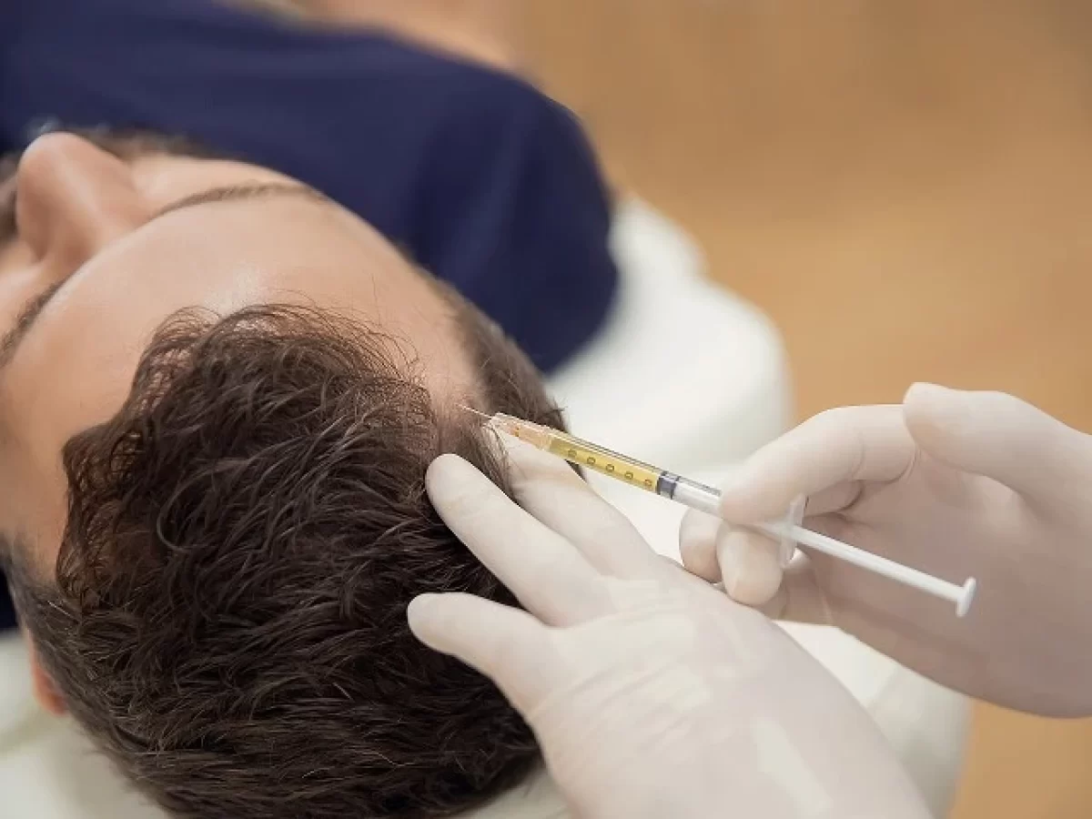 b12 injections alopecia Vitamin Injection for Hair Loss Alopecia Steroid Injection Cost &