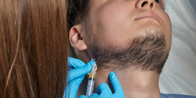 PRP Shots for Beard Growth: Before and After - Kopelman Hair